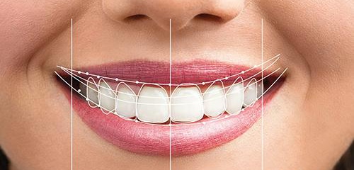 Los 5 tratamientos más demandados de Estética dental en Valencia
