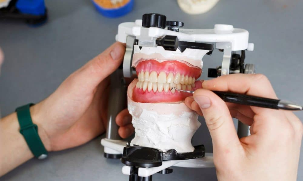 Tipos de Prótesis Dental Fija: Una Guía Completa