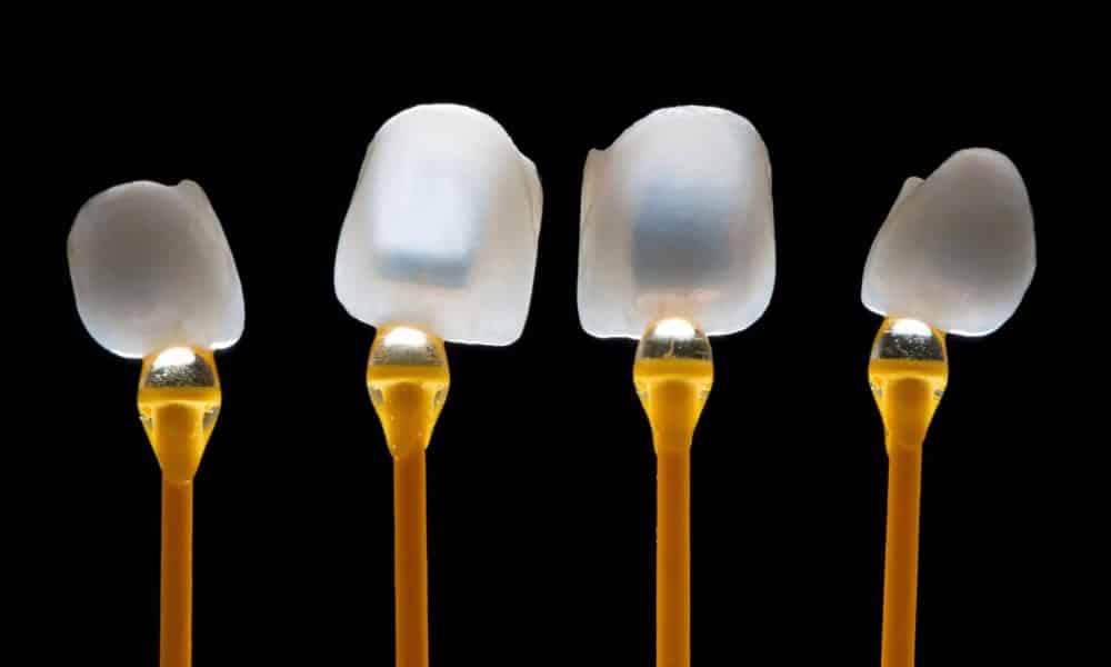 microcarillas dentales estéticas